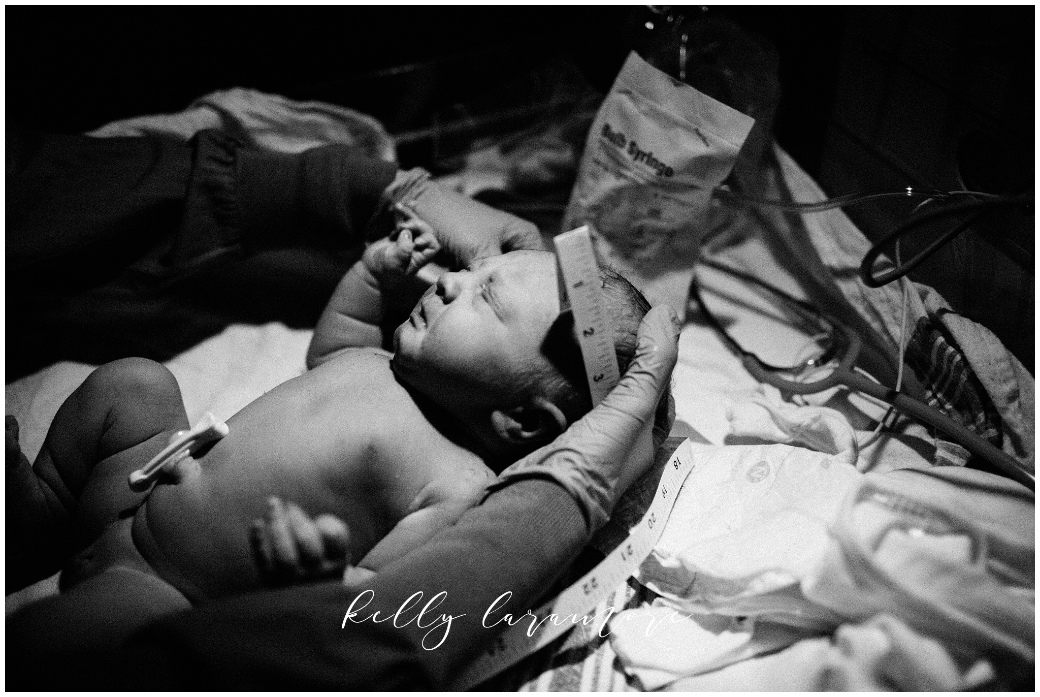 st louis birth story photographer, st louis family photographer, missouri baptist birth center birth, delivery room, baby being measured