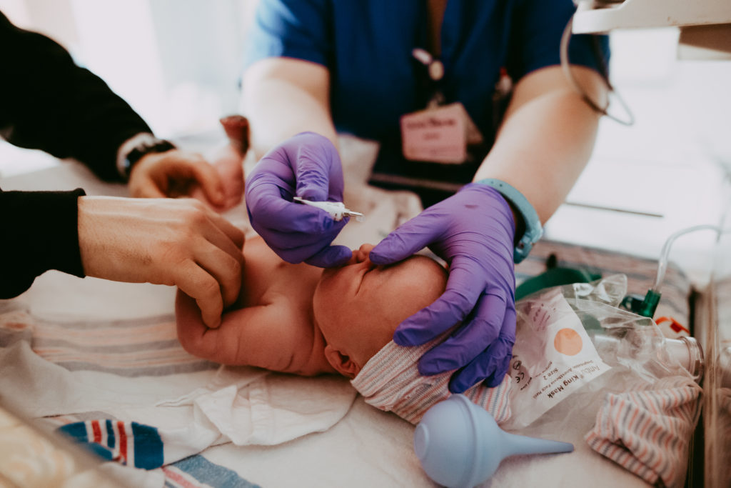 Nurse applying eye ointment on newborn baby after birth. 
